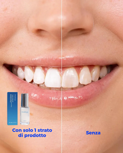 Chic™ - Sbiancante Denti Istantaneo