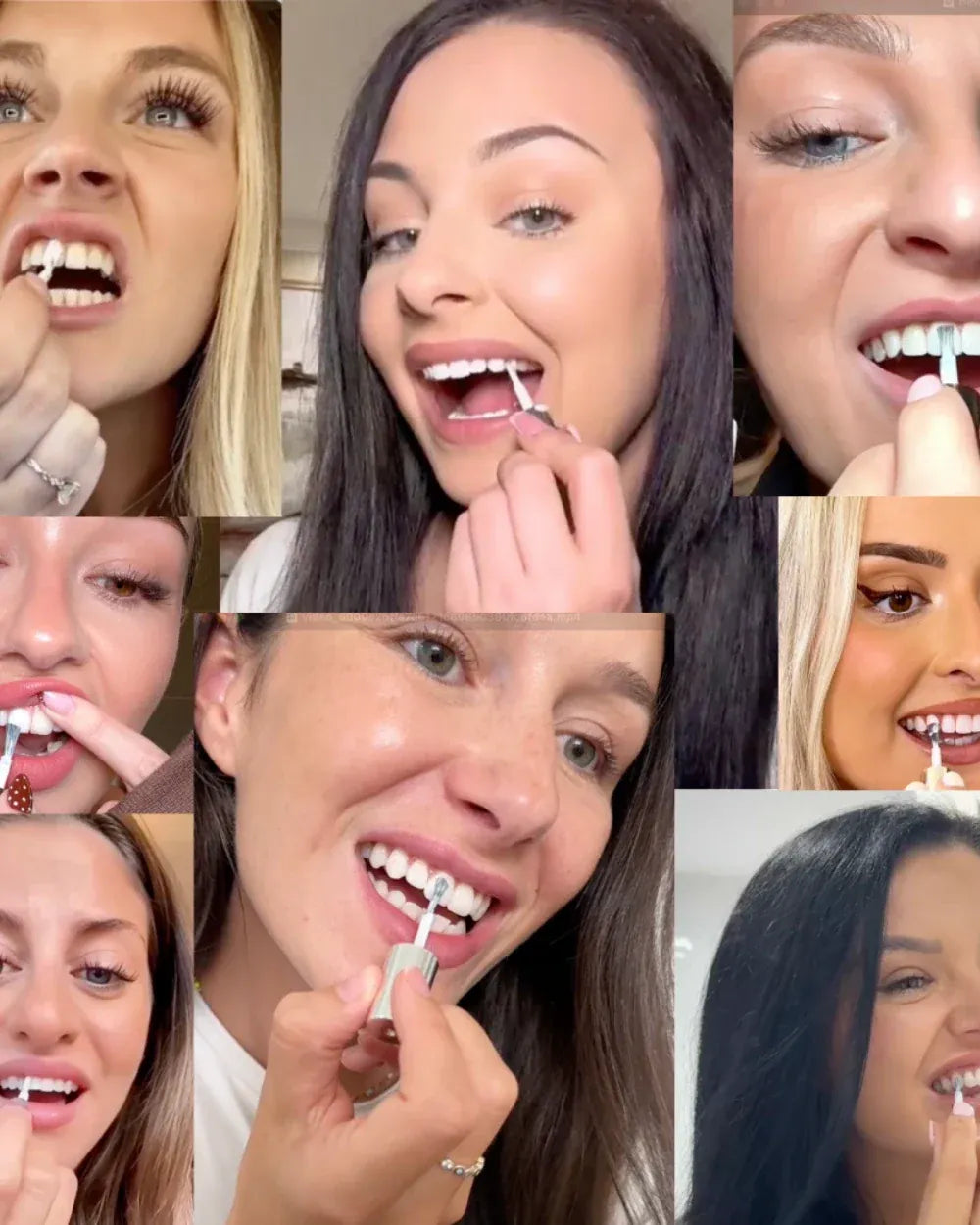 Chic™ - Sbiancante Denti Istantaneo