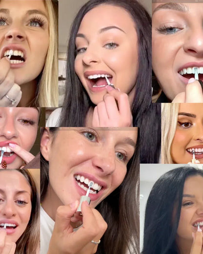 Chic™ - Sbiancante Denti Istantaneo